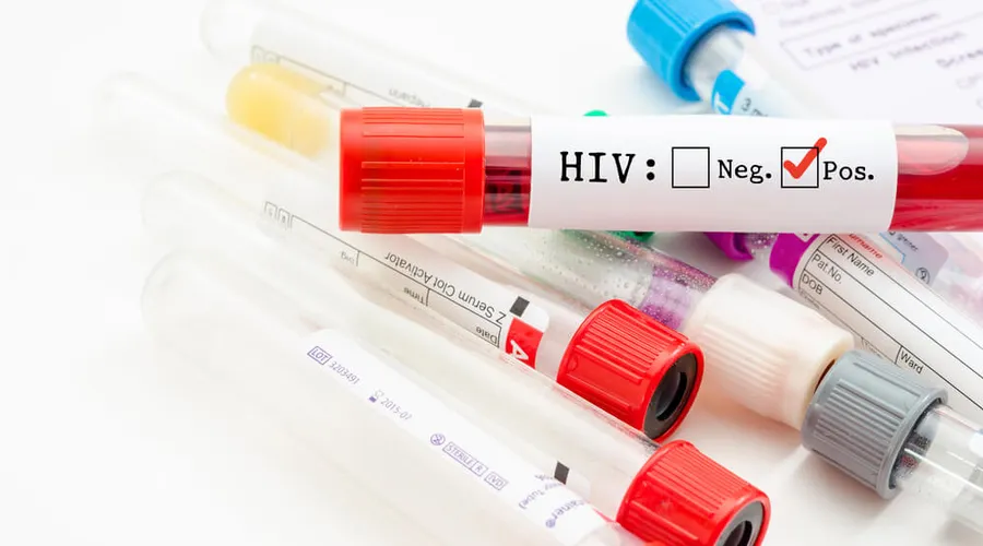 İzmir'de 13 Yaşında Bir Çocuk AIDS Nedeniyle Hayatını Kaybetti