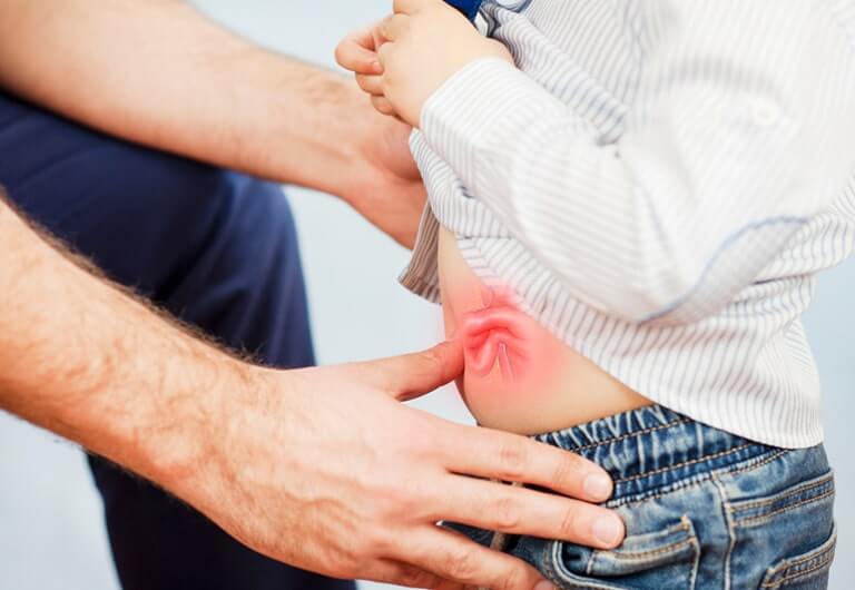 Çocuklarda Kasık Fıtığı Belirtilerine Dikkat 