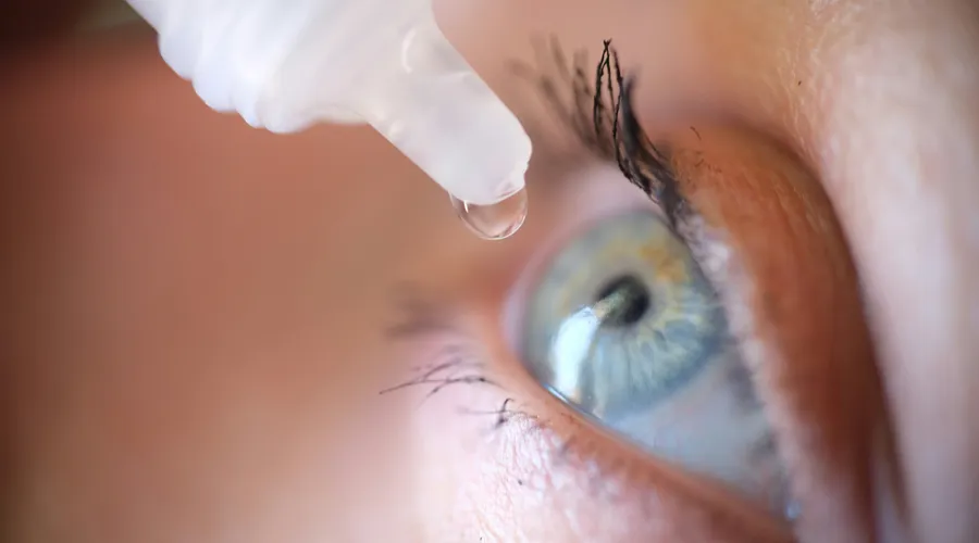 Blefarit: Göz Kapaklarının İltihaplanması ve Tedavi Yöntemleri