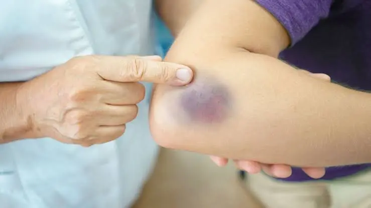 Cildiniz Morarıyorsa Dikkat!