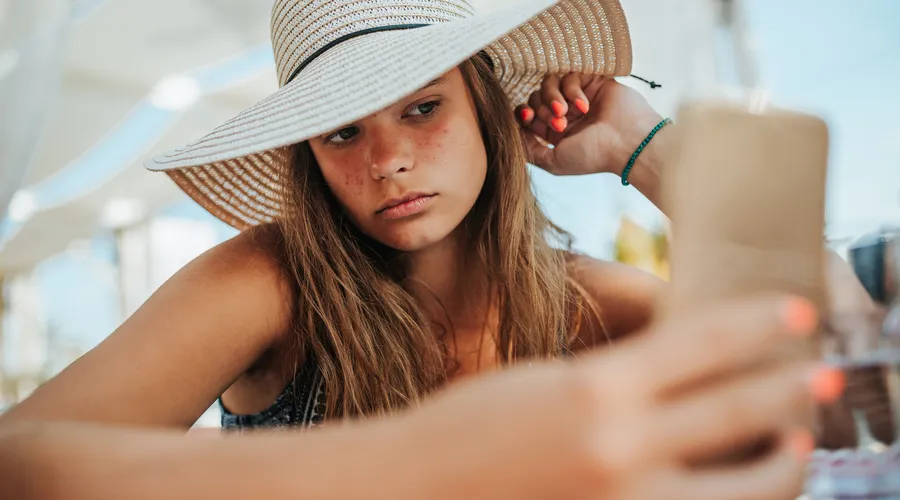 Tatil Sonrası Güneş Lekeleri Nasıl Geçer?