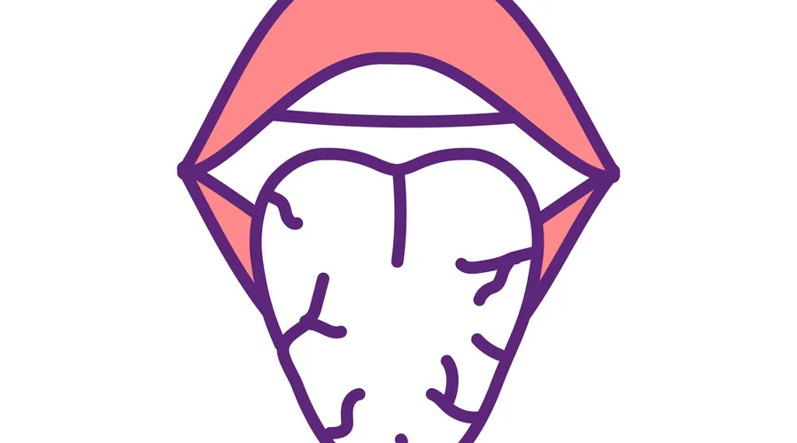 Ağız Kuruluğu (Xerostomia)