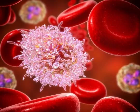 Lösemide Erken Tanı Ve Tedavi Kritik Rol Oynuyor