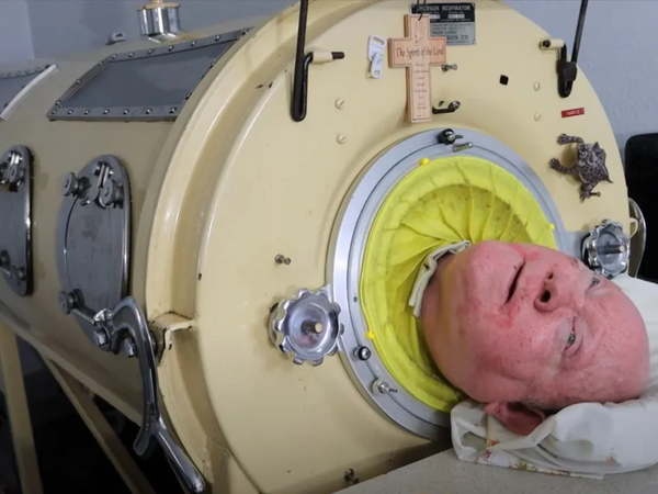 72 Yıl "Demir Akciğer"le Yaşayan Polio Paul Hayatını Kaybetti