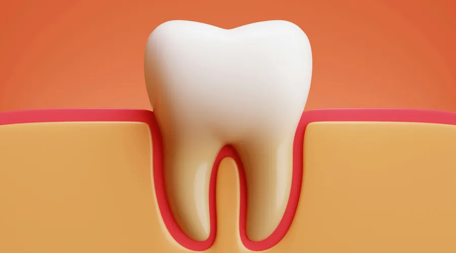 Diş Eti Kanaması: Sebepler, Belirtiler ve Çözüm Önerileri