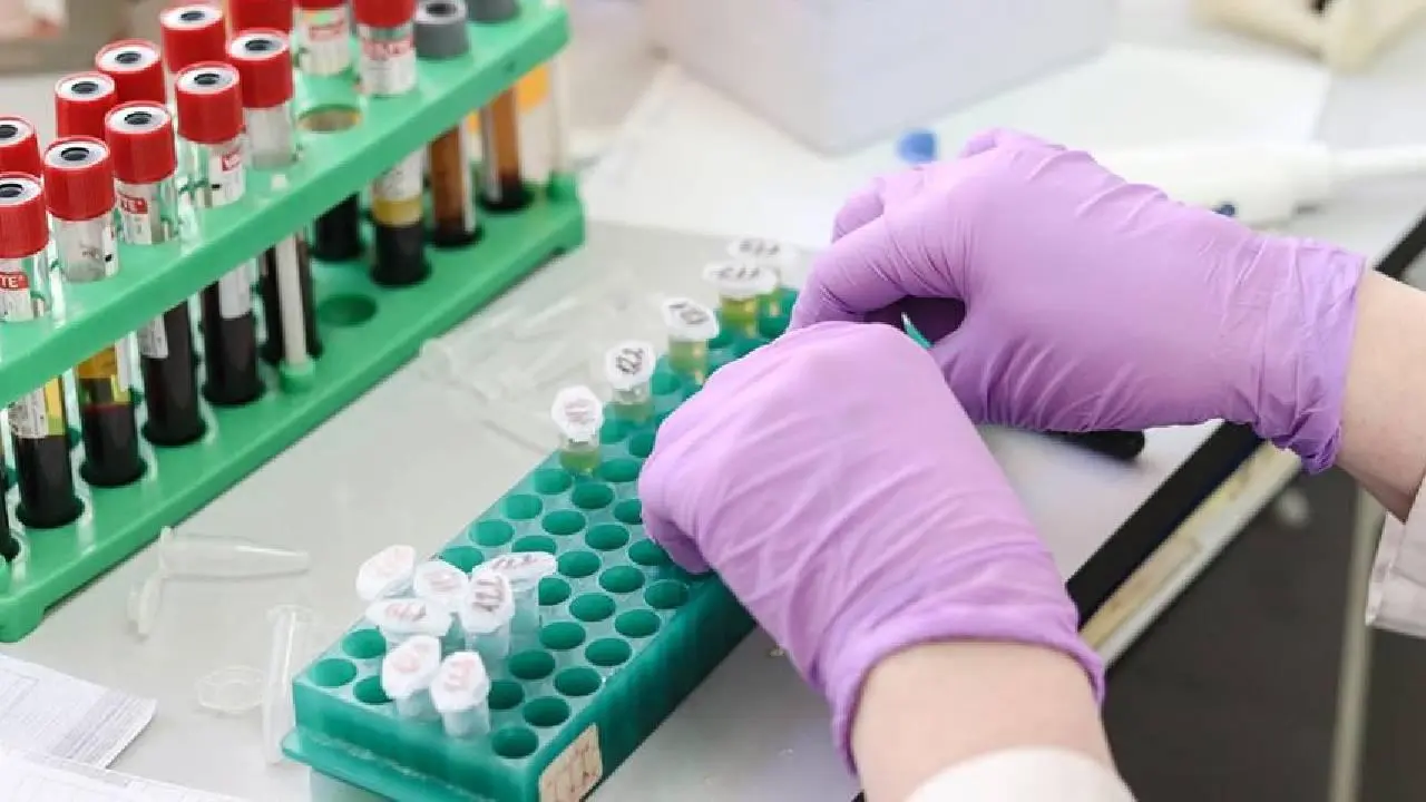 Eşler ve Eş Adayları İçin SMA Taşıyıcı Tarama Programı